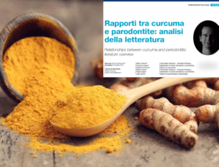 La curcuma nel trattamento della piorrea