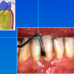 Mal di denti cosa fare Prof. Checchi Bologna