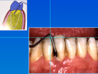 Mal di denti cosa fare Prof. Checchi Bologna