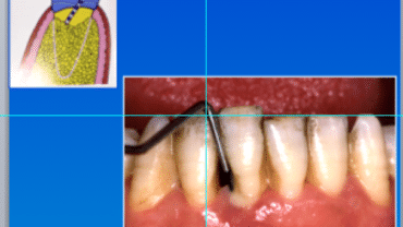 Mal di denti cosa fare Prof. Checchi Bologna