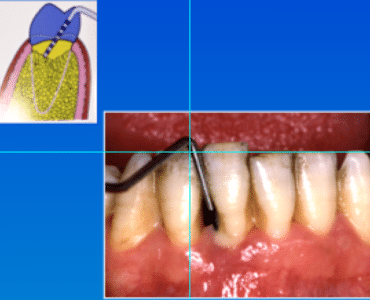 Mal di denti cosa fare Prof. Checchi Bologna