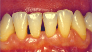 Denti belli