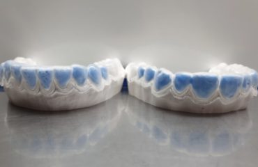 Modelli-in-gesso-sui-quali-vengono-prodotte-le-mascherine-personalizzate-2