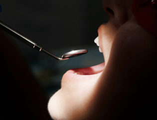 benzodiazepine in odontoiatria