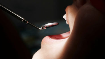 benzodiazepine in odontoiatria