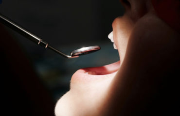 benzodiazepine in odontoiatria