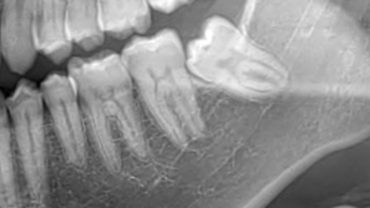 dente del giudizio
